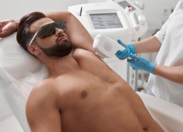 Laser Hair Removal