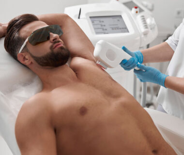 Laser Hair Removal